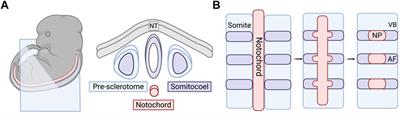 Development, Pathogenesis, and Regeneration of the Intervertebral Disc: Current and Future Insights Spanning Traditional to Omics Methods